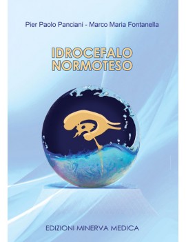 IDROCEFALO NORMOTESO